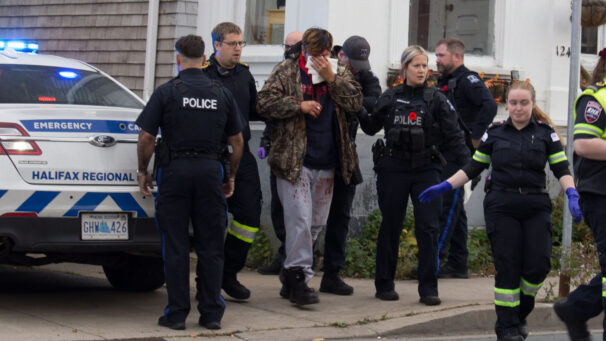 A man in a camouflage jacket and bloodied sweatpants holds gauze to his face as police officers escort him to an ambulance.